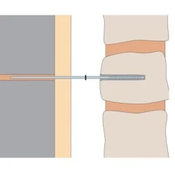 180mm Ancon Staifix Cavity Starter Tie with Plug - pack of 100