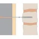180mm Ancon Staifix Cavity Starter Tie with Plug - pack of 100 180mm Ancon Staifix Cavity Starter Tie with Plug - pack of 100
